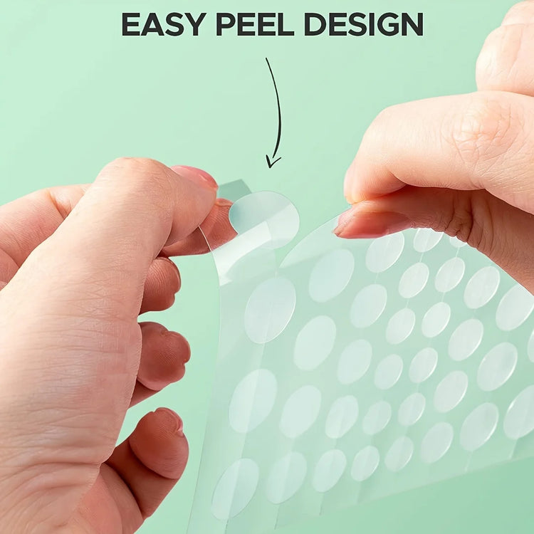 400/800pcs HITWORKER Hydrocolloid Acne Patches, 2 Sizes, Day & Night Use, Beige, Oil Control, Fragrance-Free
