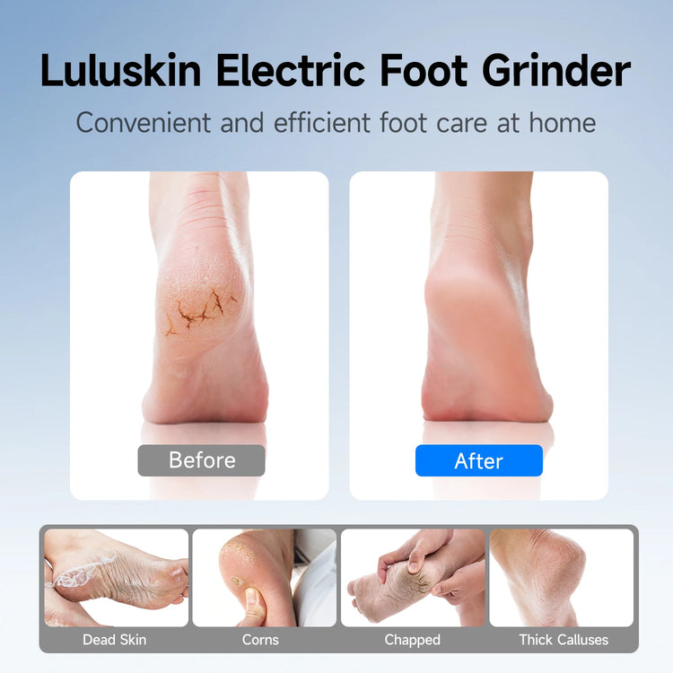 Electric Foot Grinder Auto Foot Callus Remover 3 Speeds Rechargeable Portable Foot Polishing Dry Hard Dead Skin Cracked Removal
