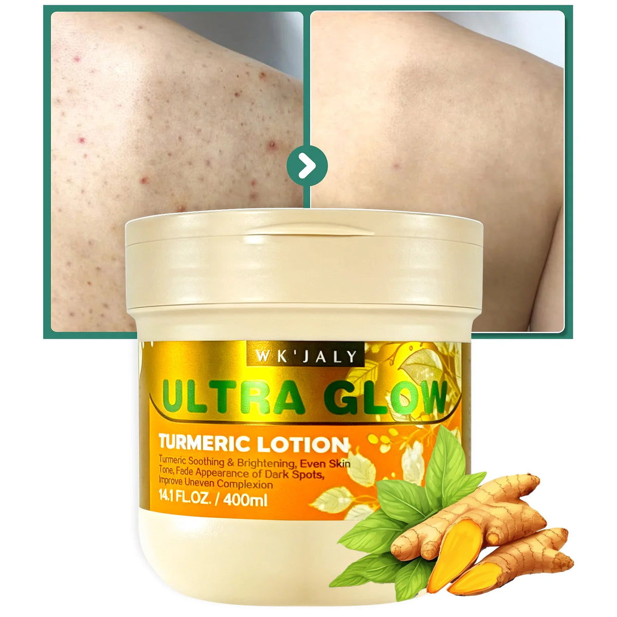 WK JALY Ultra Glow Turmeric Body Lotion, Brightening, Even Skin Tone, Deeply Moisturize Skin, Fade Dark Spots, Hyperpigmentation