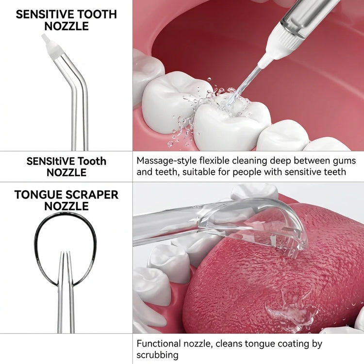 Replacement Oral Irrigator Nozzles, Water Flosser Brush Heads Compatible with L-8/9/12/13/15, Dental Scaler Tips, Oral Care