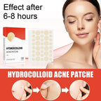 144pcs Face Acne Patch Invisible Skin Care Pimple Acne Patches Anti-inflammatory Healing Absorbing Spot Sticker Covering Acne