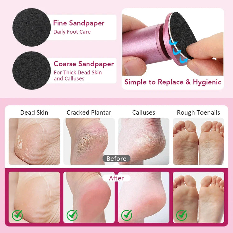 Electric Foot File, USB Powered Callus Remover Adjustable Speed 360 Degree Rotation 20 Sandpaper Discs for Dead Skin Heel Care
